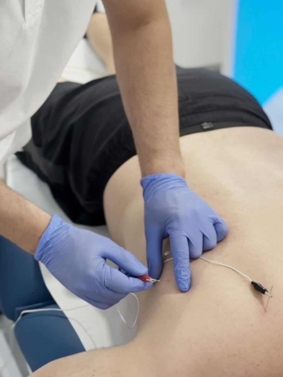 Improve Fisioterapia Cabezo de Torres - Punción Seca Murcia Improve Fisioterapia Cabezo de Torres - Punción Seca Murcia
