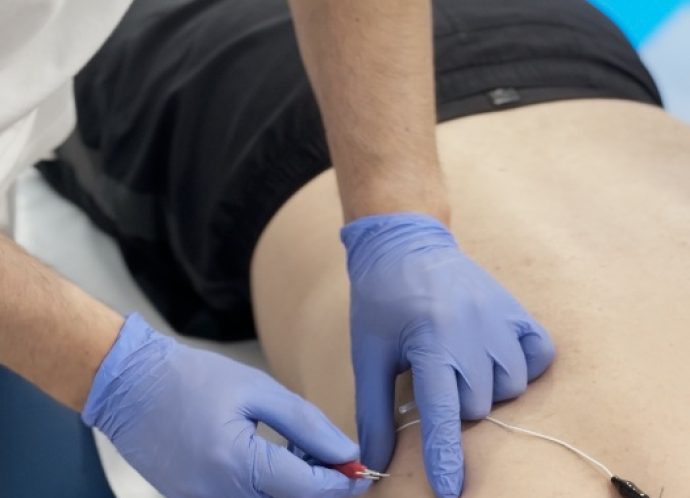Improve Fisioterapia - Cabezo de Torres - Punción Seca en Murcia Fisioterapia general y rehabilitación - Improve Fisioterapia - Cabezo de Torres - Murcia